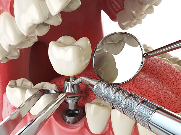 Best Emergency Dental Surgery in Yale, MI
